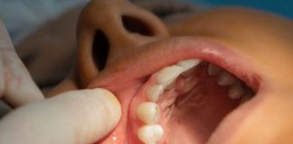 Chirurgie-dentoalveolara