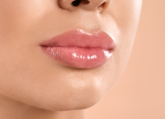 Cheiloplastia