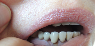 Chirurgia paradontală