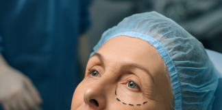 Blefaroplastia inferioară