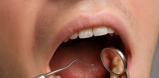 Rezecția chisturilor odontogene