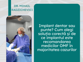 implant dentar