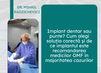 Implant dentar sau punte? Cum alegi soluția corectă și de ce implantul este recomandarea medicilor OMF în majoritatea cazurilor implant dentar