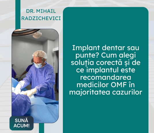 implant dentar
