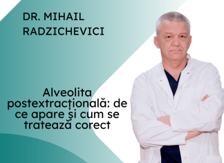 alveolita postextracțională