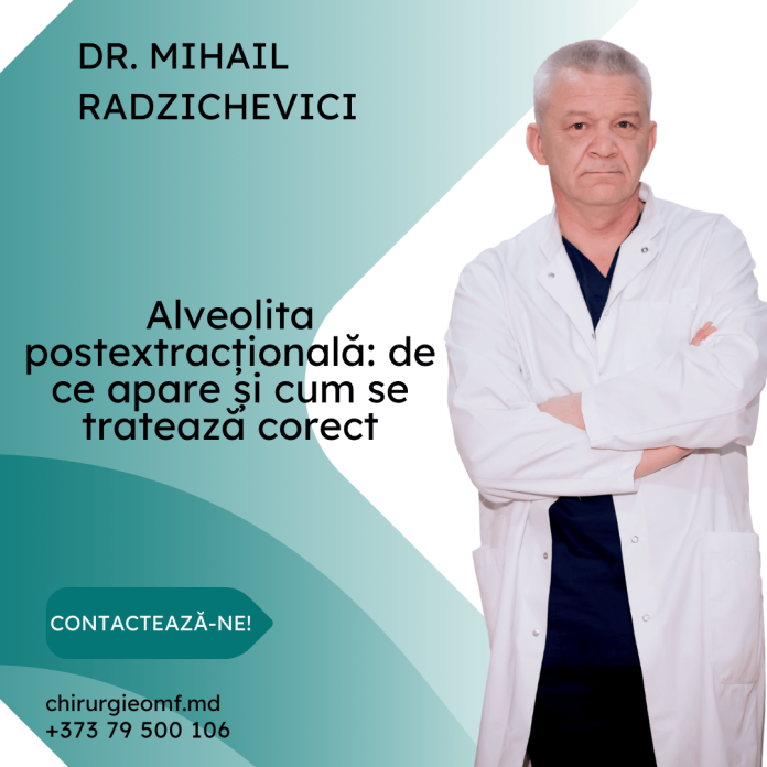 alveolita postextracțională