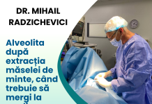 Alveolita după extracția măselei de minte, când trebuie să mergi la medic alveolita