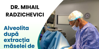 alveolita