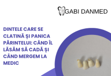Dinte de lapte care se clatină la copil – afiș GABI DANMED cu incisivi de lapte