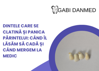 Dinte de lapte care se clatină la copil – afiș GABI DANMED cu incisivi de lapte